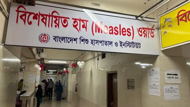 হামের উপসর্গে আরও ৫ শিশুর মৃত্যু